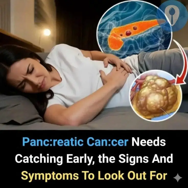 Pancreatic Cancer: 10 Early Warning Signs You Should Never Ignore