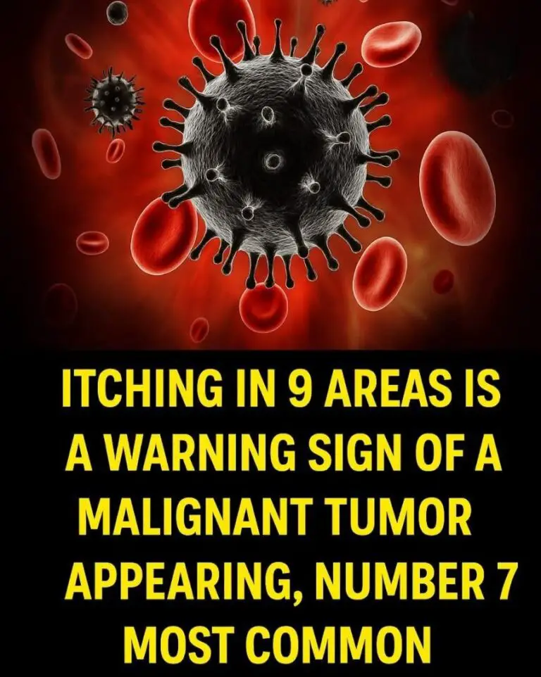 Itching in 9 Areas: A Warning Sign of Malignant Tumors? What You Actually Need to Know
