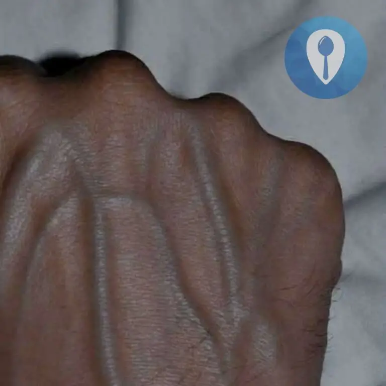 If Your Hand Veins Are Visible, Here’s What Your Body May Be Telling You