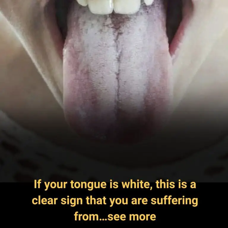 If Your Tongue Is White, This Is a Clear Sign That You Are Suffering From… – Soothing Ginger Lemon Tea Recipe