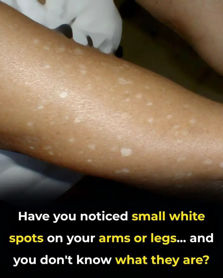 Have You Noticed Small White Spots on Your Arms or Legs? Here’s What They Are – Skin-Healthy Turmeric Milk Recipe