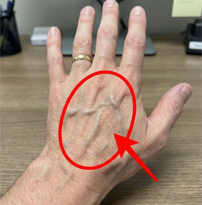 If Someone Has Visible Veins, Does It Mean Their Circulation Is Poor? Hydration Boost Herbal Drink