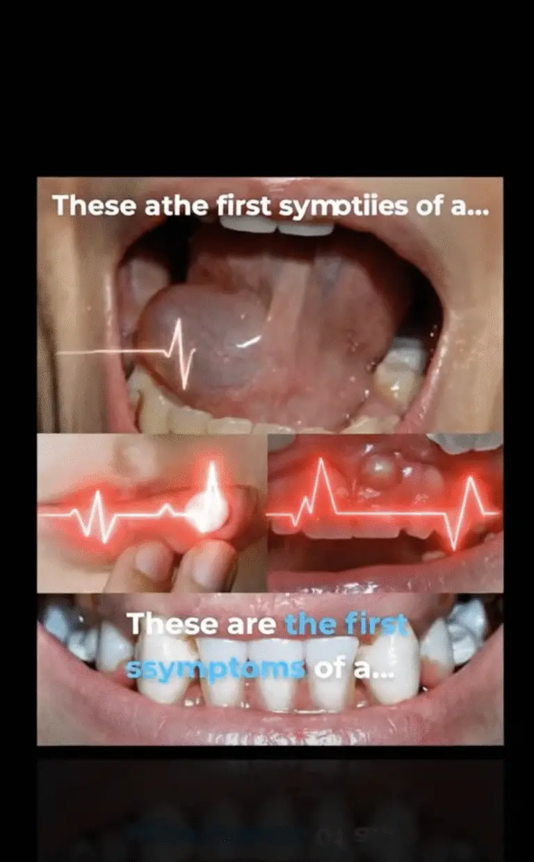 Hidden Dangers in Your Mouth: Early Signs of Oral Cancer