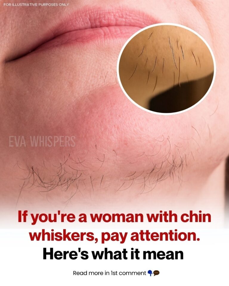Chin Whiskers on Women: Why They Happen and What Your Body Is Trying to Tell You Nourishing Green Detox Smoothie