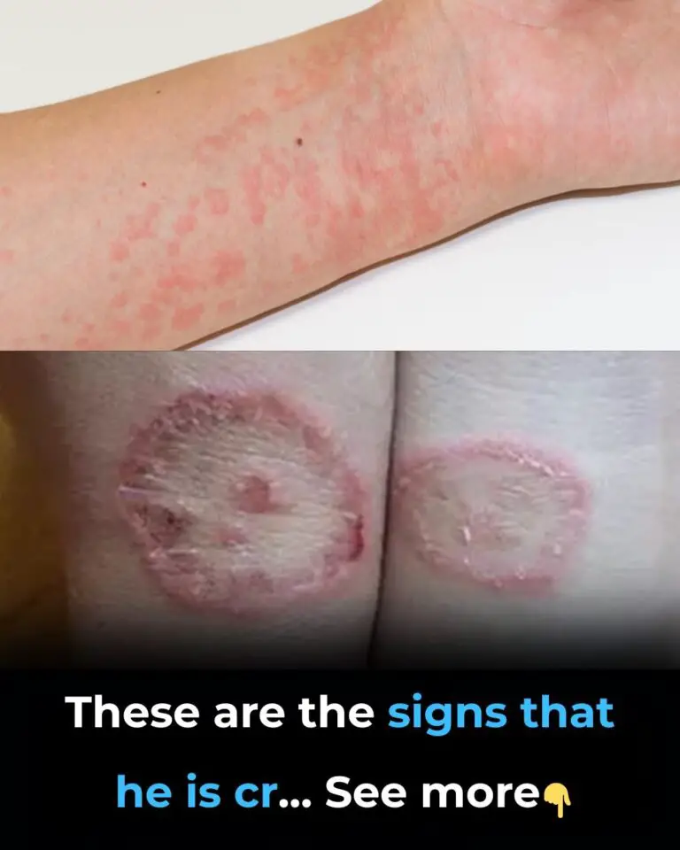 Signs of Groin Skin Irritation and How to Address Them Chocolate Peanut Energy Bars
