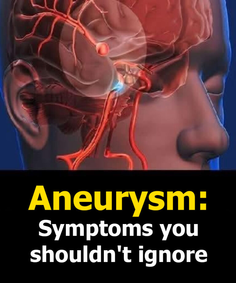Myth vs Fact: Brain Aneurysms – Brain-Boosting Berry Smoothie Recipe
