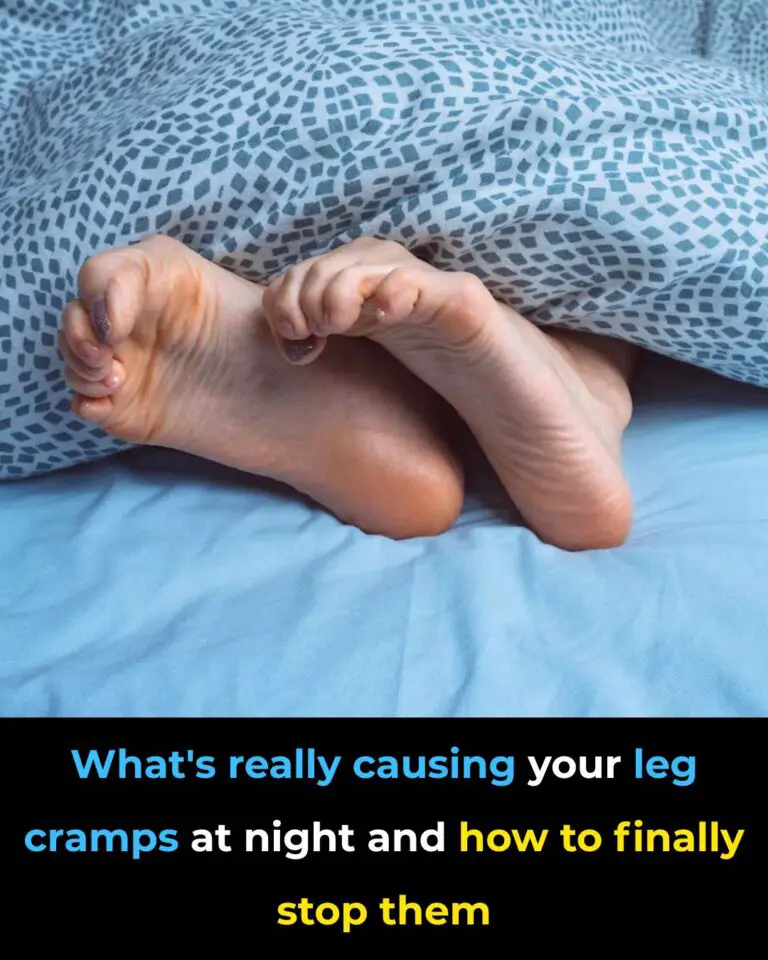 What Causes Night Leg Cramps and How to Prevent Them