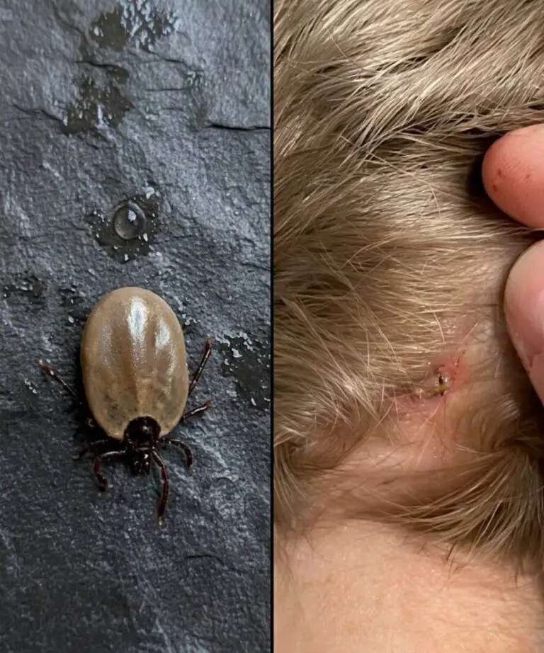How to Stay Calm When You Find a Tick on Your Child — And What Every Parent Should Know Next