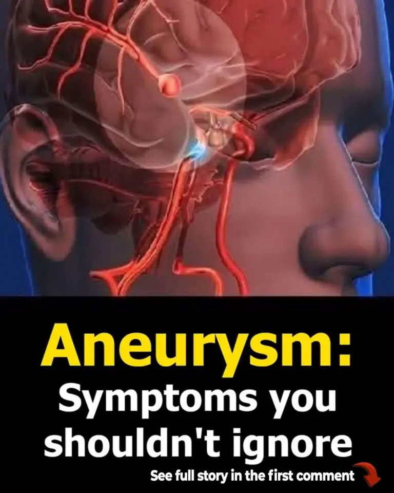 12 Early Warning Signs of an Aneurysm You Should Never Ignore