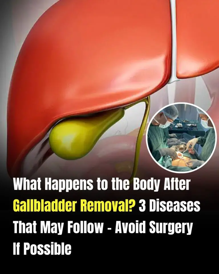 Life After Gallbladder Removal: What Really Happens to Your Body