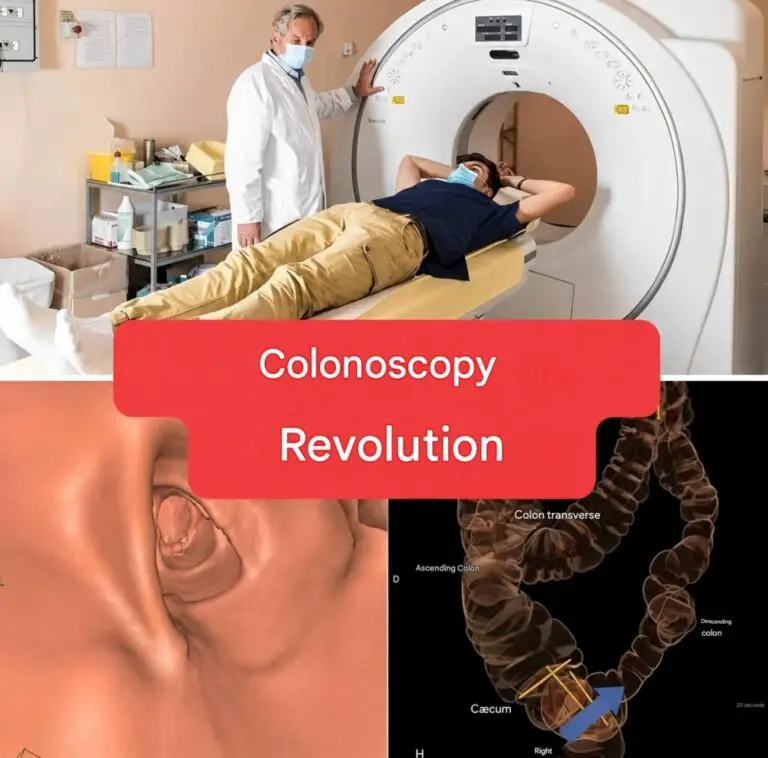 New Method: Colonoscopy Will No Longer Be an Invasive Examination