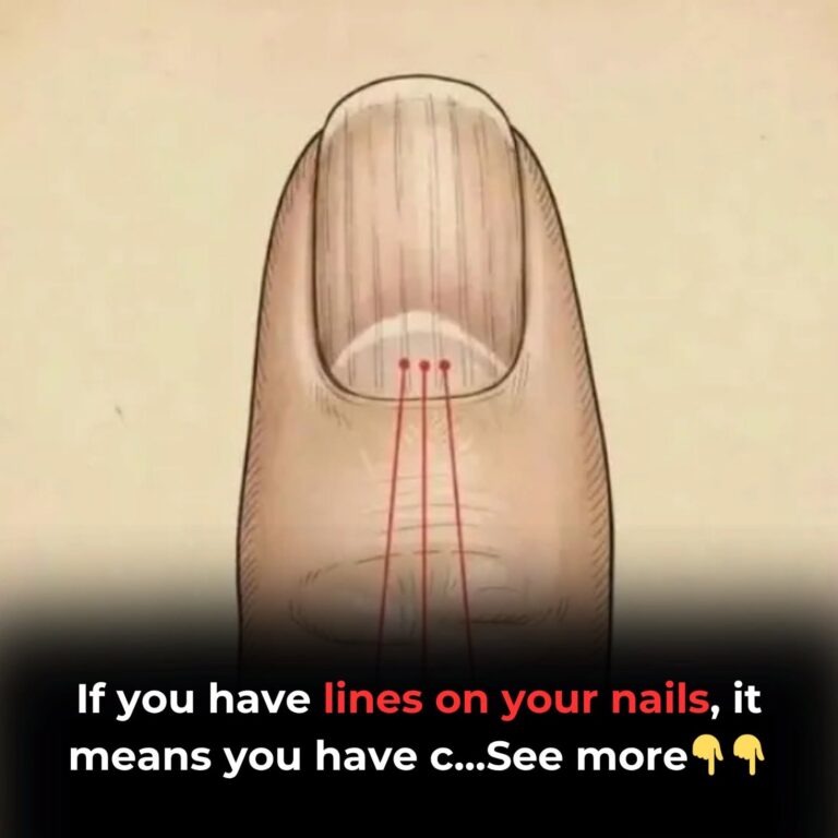 If You Have Lines on Your Nails, Here’s What They Could Really Mean