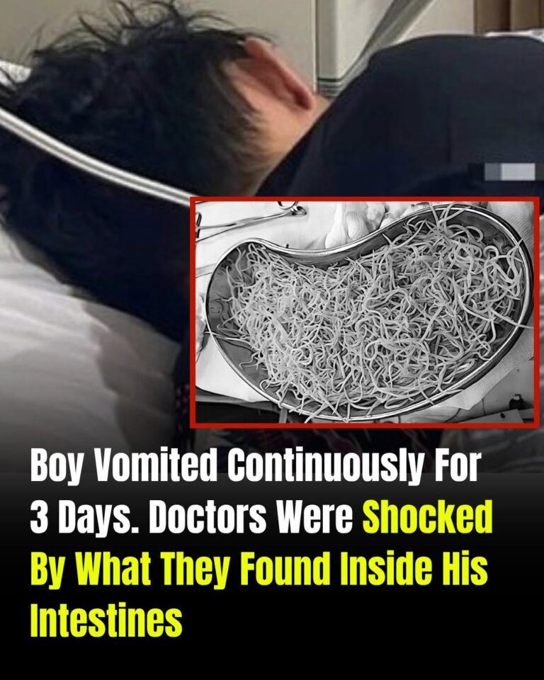 Boy Vomited for Three Days Straight — Doctors Were Shocked by What They Found