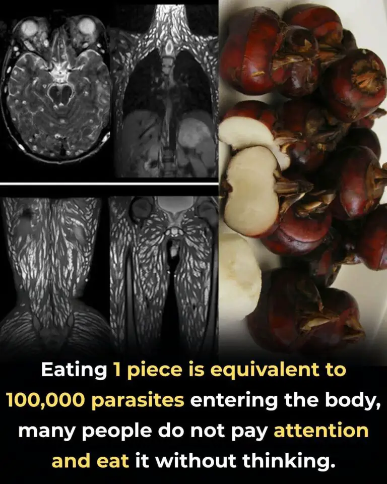 Eating Just One Bite Can Be Harmful: The Hidden Danger of Foodborne Parasites and How to Protect Yourself