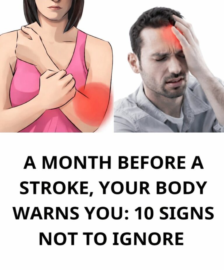 Warning Signs of a Stroke Your Body May Show: What to Watch For and How to Act Fast