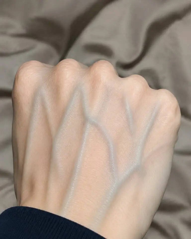 What the Veins on Your Hands Might Reveal About Your Kidney Health: Separating Myth from Medical Reality