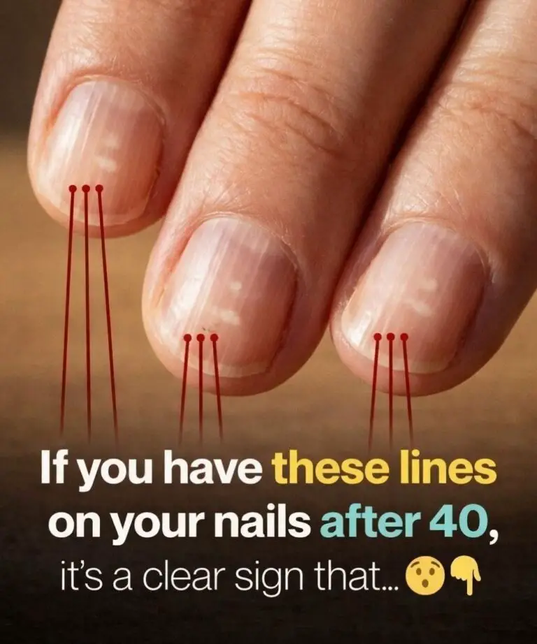 Foods That Support Stronger Nails After 40: Nourish Your Nails From the Inside Out