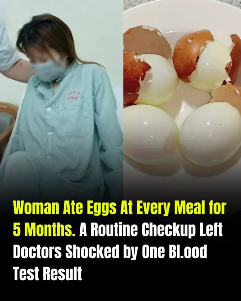 Woman Ate Eggs at Every Meal for Five Months—What Her Routine Blood Test Revealed May Surprise You