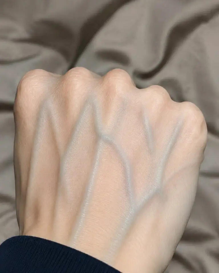 What Do the Veins on Your Hands Really Say About Your Health? Separating Common Myths From Medical Facts