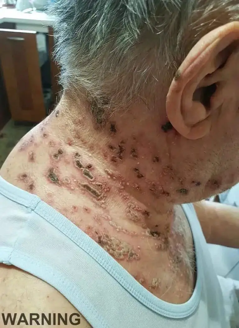 This Is the Silent Disease That Can Strike Without Warning