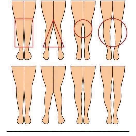 The Subtle Messages Hidden in a Woman’s Legs: Understanding Natural Variation and Body Mechanics