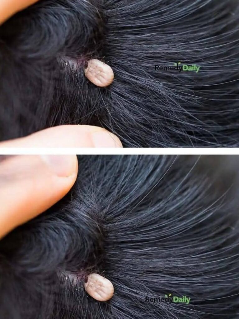 Just Discovered This in My Son’s Hair — Should We See a Doctor?
