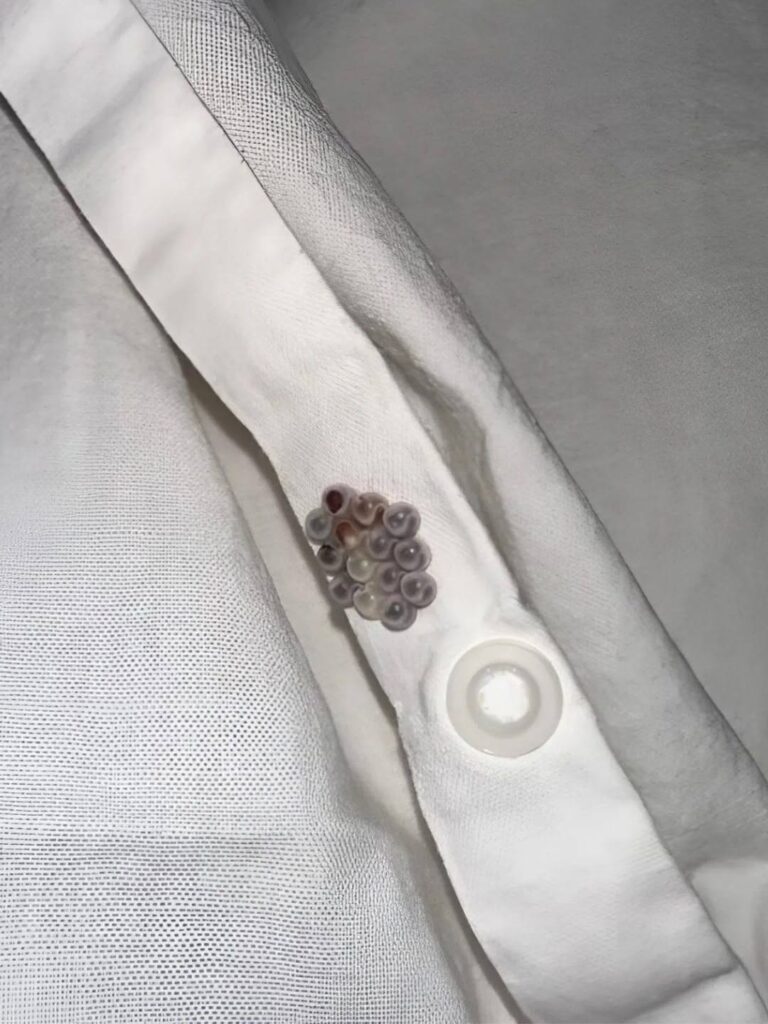 Found Tiny “Marbles” in Your Bed? Here’s What They Could Actually Be