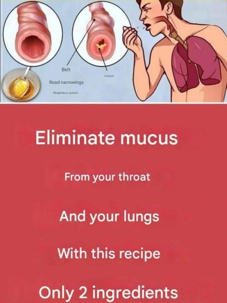 Honey and Lemon for Mucus: What This 2-Ingredient Remedy Can — and Can’t — Do