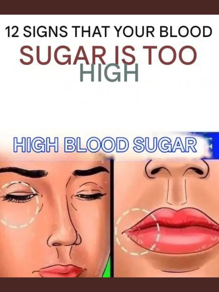 The High-Sugar Alert: Recognizing the 12 Key Symptoms Your Body is Showing You