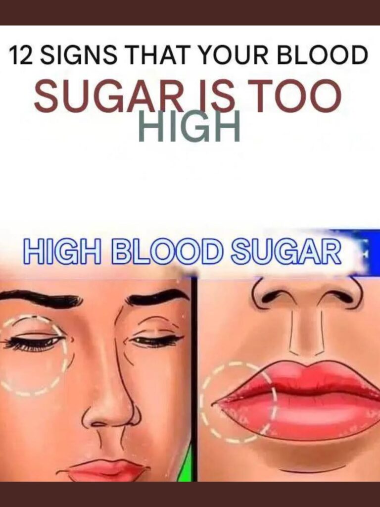 The High-Sugar Alert: Recognizing the 12 Key Symptoms Your Body Is Showing You