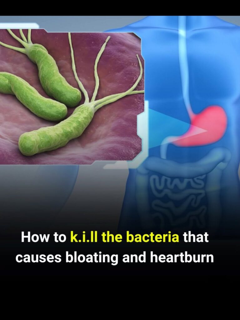 H. pylori Infection — What Science Actually Says About Treatment (Natural Support vs. Medical Necessity)