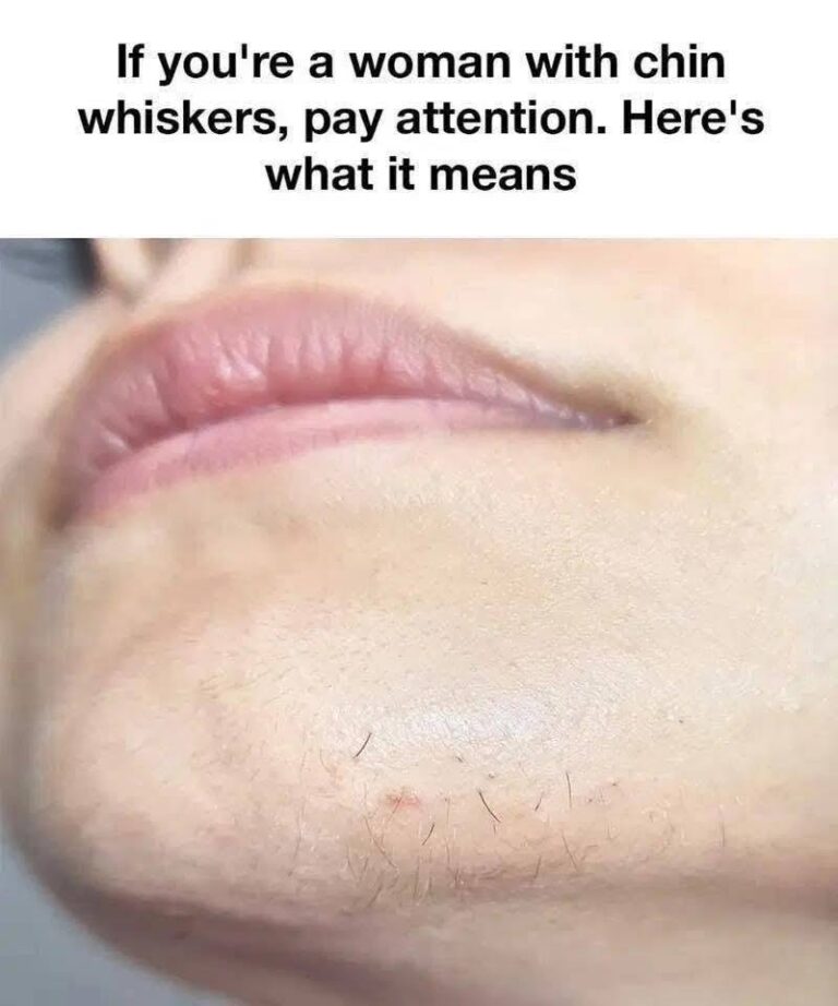 Chin Whiskers in Women — What’s Normal, What’s Not, and How to Navigate It Without Shame
