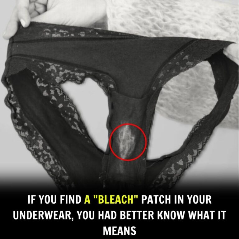 What a “Bleach” Patch on Your Underwear Really Means