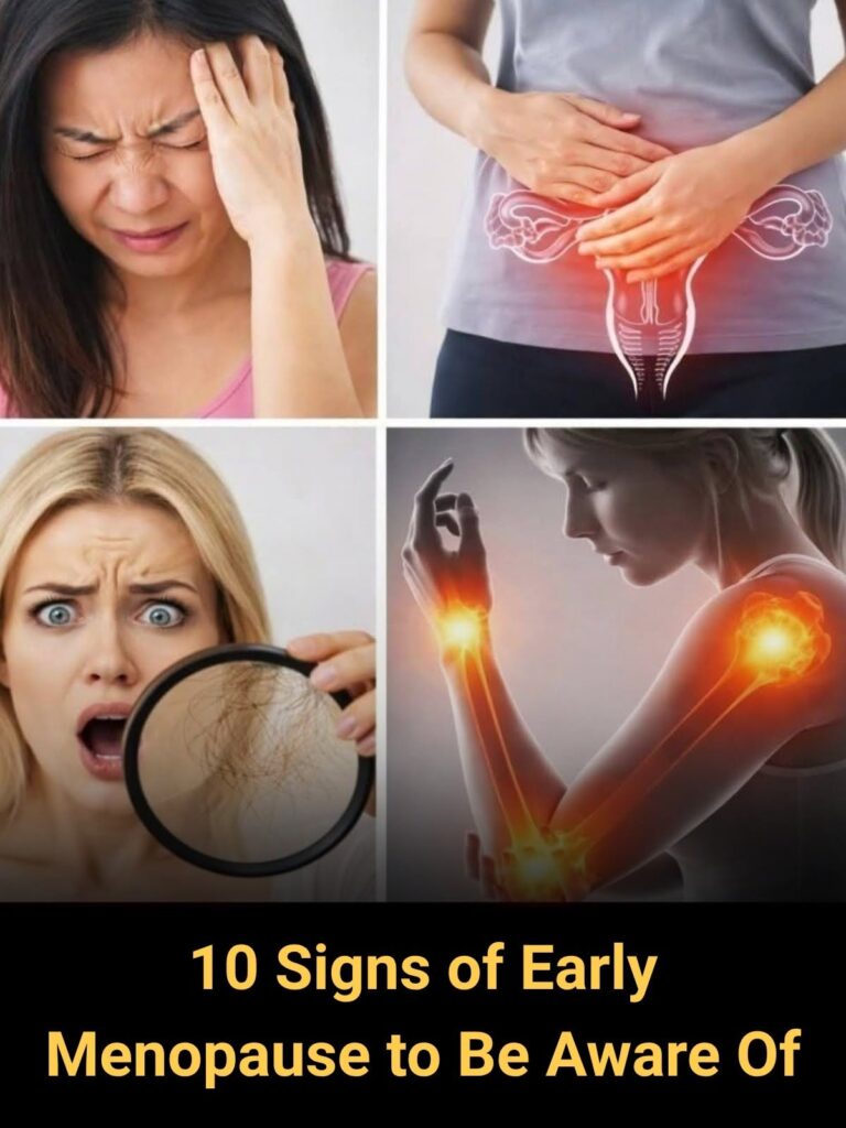 Early Menopause: 10 Signs Every Woman Should Be Aware Of