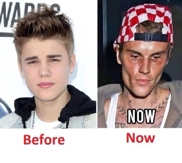 Justin Bieber admits that he tested positive for… What the Viral Headline Really Means