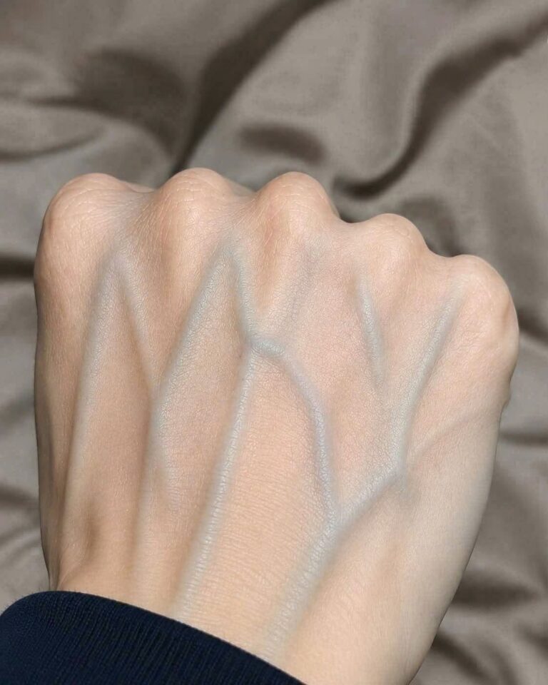 Visible Veins on Your Hands? Here’s What They Could Mean for Your Health