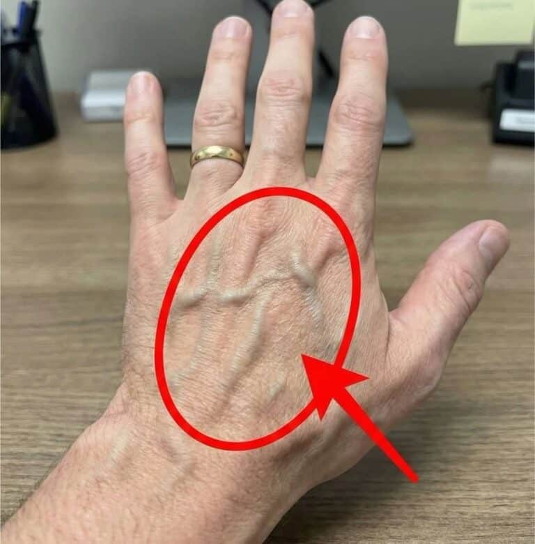 The Map Beneath Our Skin: What Your Visible Veins Can Mean and When to Pay Attention