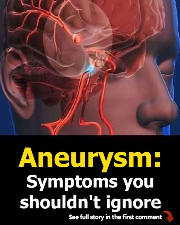 12 Early Warning Signs of an Aneurysm You Shouldn’t Ignore