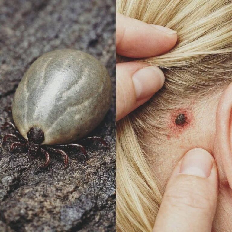 Found a Weird Bug in Your Child’s Hair? What Parents Should Know