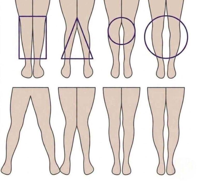 Which One Are You? They Say Your Leg Shape Says a Lot About Your Personality…