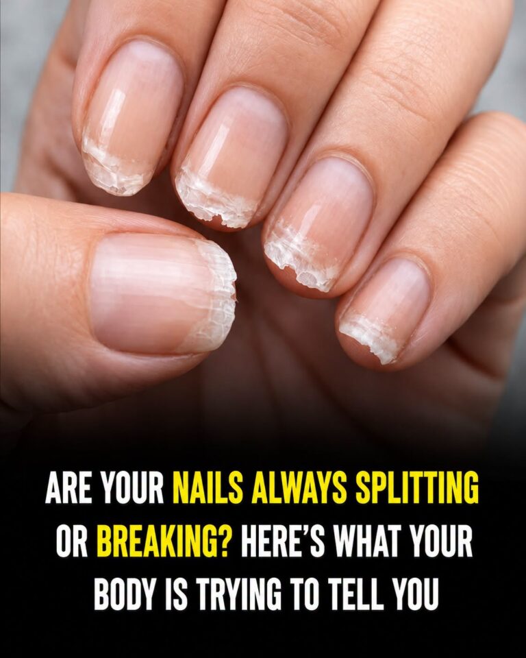 Brittle or Splitting Nails? Here’s What Your Body Might Be Trying to Tell You