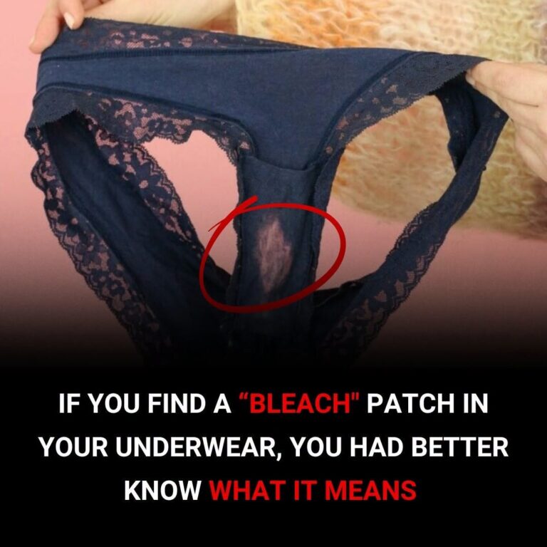 What a “Bleach” Patch on Your Underwear Means and When to Pay Attention