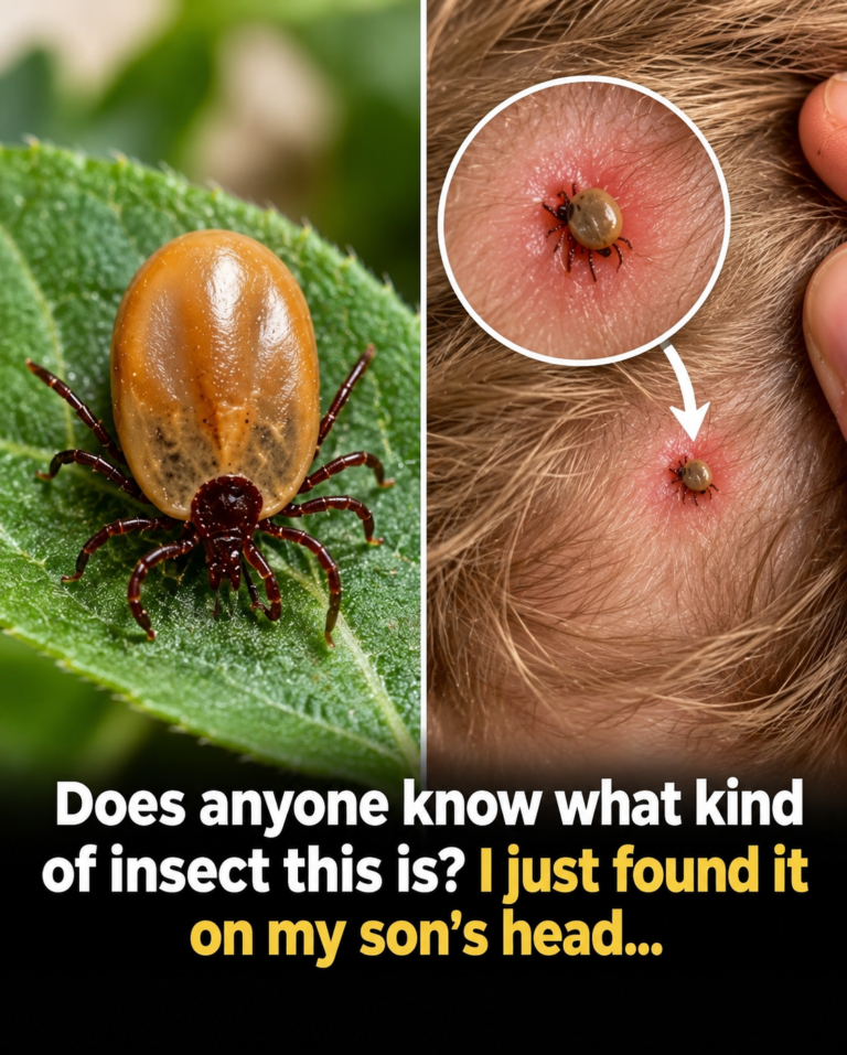 Does Anyone Know What Kind of Insect This Is? I Just Found It on My Son’s Head