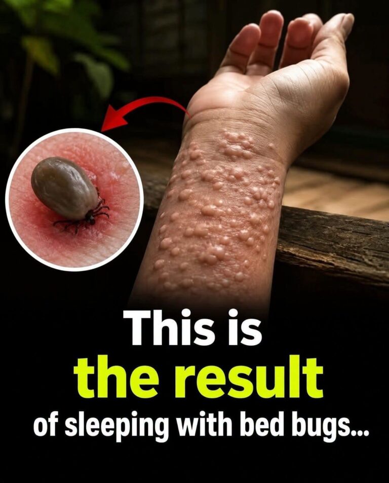 What Really Happens When Bed Bugs Invade Your Home? Warning Signs You Should Know