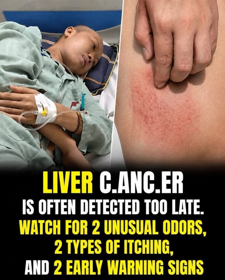 Liver Cancer: Early Warning Signs You Should Never Ignore