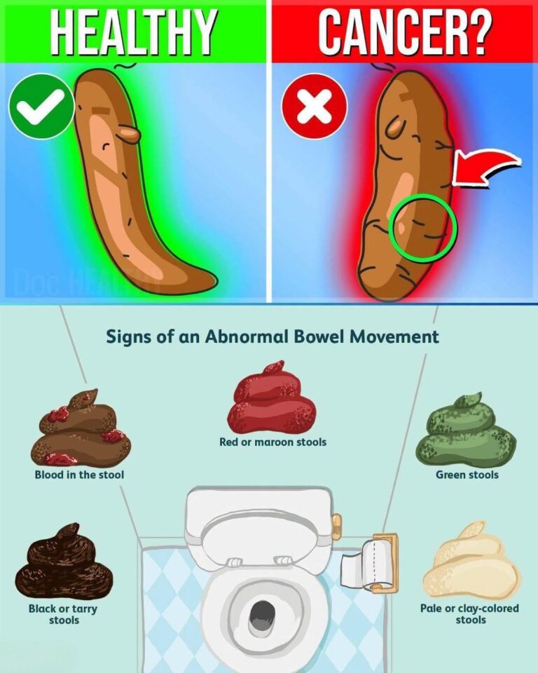 Changes in Stool Color May Be Your Body’s Way of Signaling Certain Health Conditions