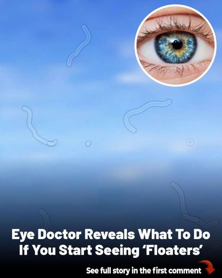Eye Doctor Explains What Those “Floating Spots” in Your Vision Could Mean