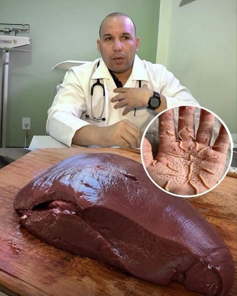 Doctors Reveal What Can Happen If You Eat Beef Liver Too Often